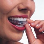 Invisalign1