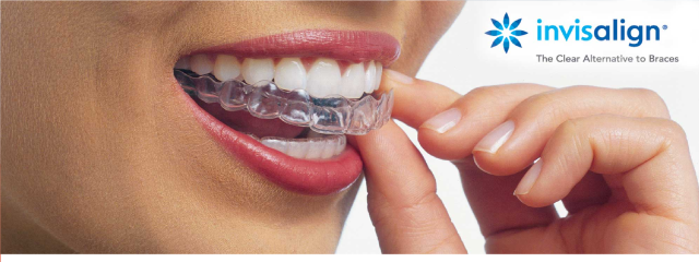 invisalign